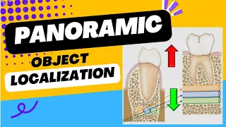 Panoramic | Panoramic x-ray beam | Vertical relationships between the objects