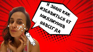 Как избавиться от подкожников