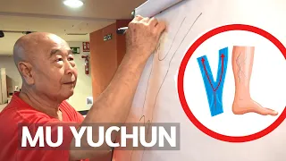 Stop varicose veins. We remove blood stagnation. Mu Yuchun.
