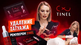 Удаление татуажа ремувером Tinel