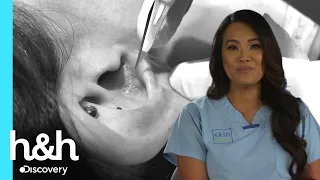 Complicada extracción de puntos negros dentro de la oreja | Dra. Sandra Lee | Discovery H&H