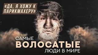 Самые волосатые люди: гипертрихоз | Хочу спросить