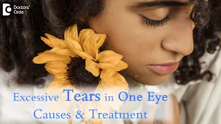 Excessive tearing in one eye? What can it be? - Dr. Sunita Rana Agarwal | Doctors' Circle