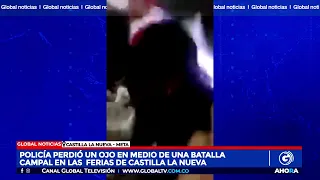 POLICÍA PERDIÓ UN OJO EN MEDIO DE UNA BATALLA CAMPAL EN LAS  FERIAS DE CASTILLA LA NUEVA