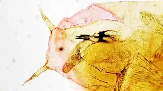 Drosophila larva Under the Microscope