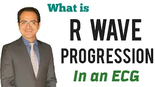 R Wave Progression in ECG, R Wave Abnormalities in an ECG, ECG Lectures USMLE, Neet pg