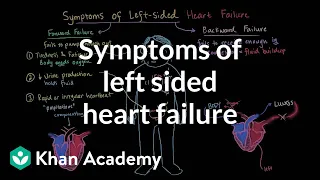 Symptoms of left sided heart failure | Circulatory System and Disease | NCLEX-RN | Khan Academy