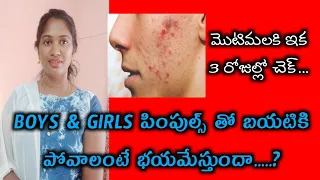 pimple clear skin home remedies||natural glow&clean skin||sunitha talks....