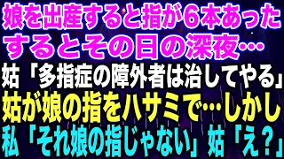 【スカッとする話】娘を出産すると指が６本あったするとその日の深夜…姑「多指症の障外者は治してやる」姑が娘の指をハサミで…しかし私「それ娘の指じゃない」姑「え？」【修羅場】