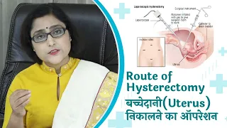 बच्चेदानी निकलने के लिए कौन सा आपरेशन कराएं ? दूरबीन या फिर हाथ वाला. routes of hysterectomy