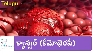 క్యాన్సర్ (కీమోథెరపీ)| Cancer (Chemotherapy) | Telugu