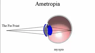 Lecture 8, Focal Points and Ametropia