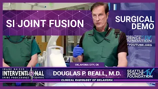 SI Joint Fusion - Douglas Beall, M.D.