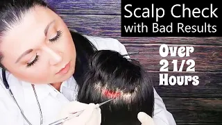 ASMR Scalp Check with Bad Results Compilation (Scalp Treatment, Whispering) Medical Roleplay