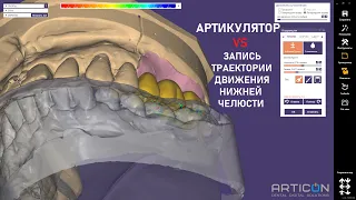 Артикулятор VS Запись движения нижней челюсти в Exocad