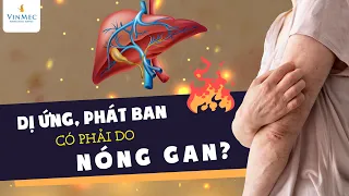 Dị ứng, phát ban có phải do nóng gan?| BS Nguyễn Duy Bộ, BV Vinmec Times City