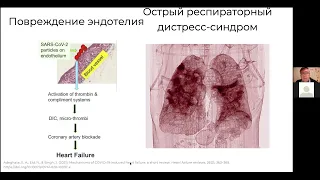 Вячеслав Дубынин ФЧЖ магистры 2021 КОВИД 2