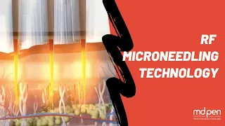 How Radio Frequency MicroNeedling Works | Intensif RF