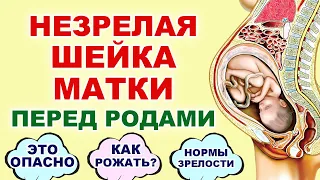 На какой неделе беременности созревает шейка матки? Незрелая шейка матки, что это значит? Созревание