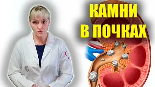 Первые Симптомы Камней В Почках У Мужчин и Женщин. Что Делать?   Лечение И Удаление Без Операции