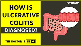 How Is Ulcerative Colitis Diagnosed? | Role of Endoscopy in Ulcerative Colitis (Hindi) | Practo