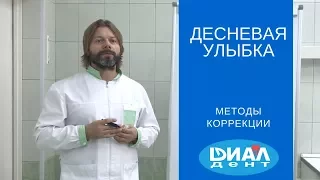 Десневая улыбка Gummy Smile. Методы коррекции.