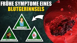 10 Frühe Symptome eines Blutgerinnsels, die du niemals ignorieren solltest