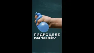 Гидроцеле или водянка яичка