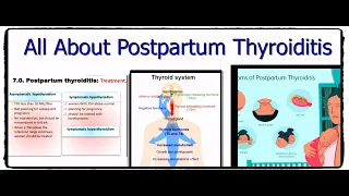 Thyroid Diseases (part 3):POST PARTUM THYROIDITIS.التهاب الغده الدرقيه الذى يحدث للسيدات بعد الولاده