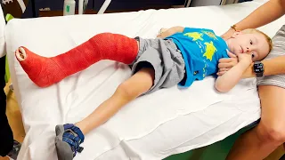 MY 3 YEAR OLDS BROKEN LEG ADVENTURE