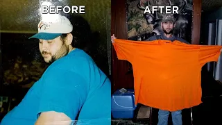 See Man’s Incredible Skin Removal Surgery After Losing 550 Pounds