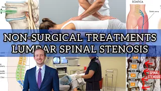 Non-Surgical Treatment For Lumbar Spinal Stenosis (Part 1)