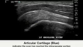 How To: Anterior Shoulder Pathology Case Study Video