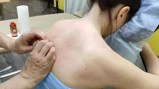 Методика комбинированного массажа при остеохондрозе шейно грудного отдела позвоночника