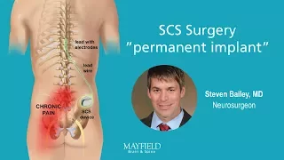 HF10 Spinal Cord Stimulation: Part 2 Surgery