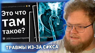 РЕАКЦИЯ T2x2: Врачи Рассказывают о ХУДШИХ Травмах из-за Ceк$@ #2