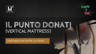 L'eleganza incontra la forza: Il punto Donati | Surgery&Chill