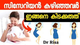 Best Sleep Position After Cesarean|Care After Delivery