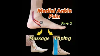 Medial Ankle Pain: Instant Pain Relief!