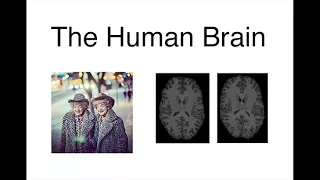 Extraordinary Variations of the Human Mind: Dan Geschwind: Our Brains: Life on a Continuum