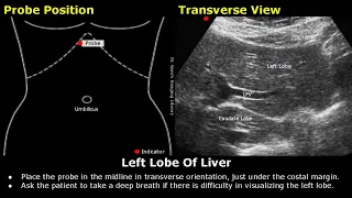 Abdominal, Gynecological & Obstetric Ultrasound Probe Positioning | Transducer Placement USG Scan