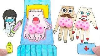 [💉 Paper DIY 😱] 🚑TINY PAPER Monster Hand Family | Baby Care Tips #08 | Pop The Pimples ASMR | 놀이 종이