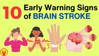 10 Warning Signs of Stroke One Month Before It Happens | VisitJoy