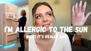 I’M ALLERGIC TO THE SUN | living with Erythropoietic Protoporphyria (EPP) | my rare genetic disorder