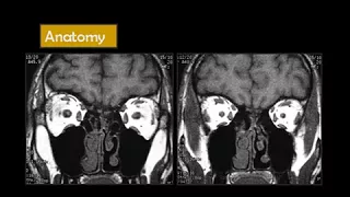 Dr Mamdouh Mahfouz head and neck imaging Orbit I