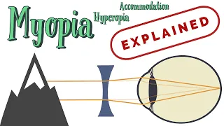 Myopia vs hyperopia (Refractive errors EXPLAINED)