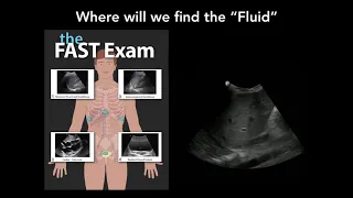 FAST Review Phase 2 Physical Exam Correlation
