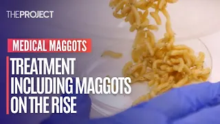 Medical Maggots: Treatment Including Maggots On The Rise Across The World