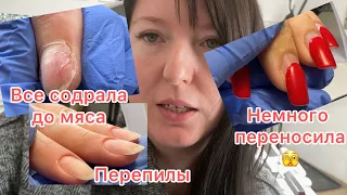 Новая клиентка. Хотела сэкономить - сходила к другому мастеру. Содрала все ногти опять🤦‍♀️