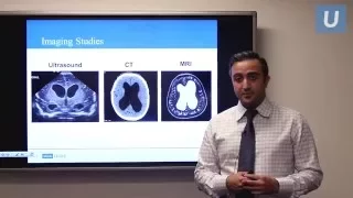 Management of Pediatric Hydrocephalus |  Aria Fallah, MD | UCLAMDChat